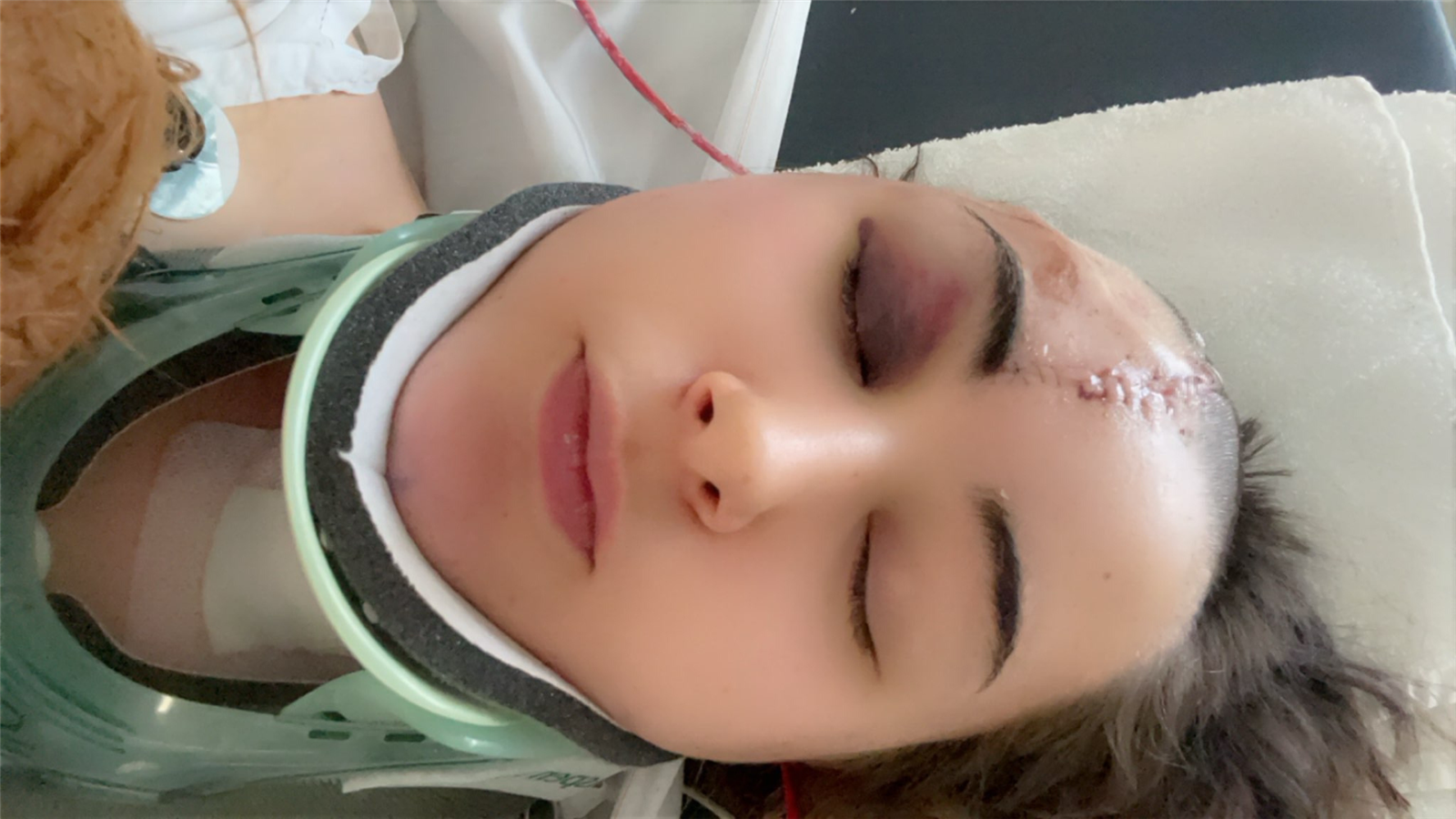 Maddison suffered life-threatening injuries as a result of an accident